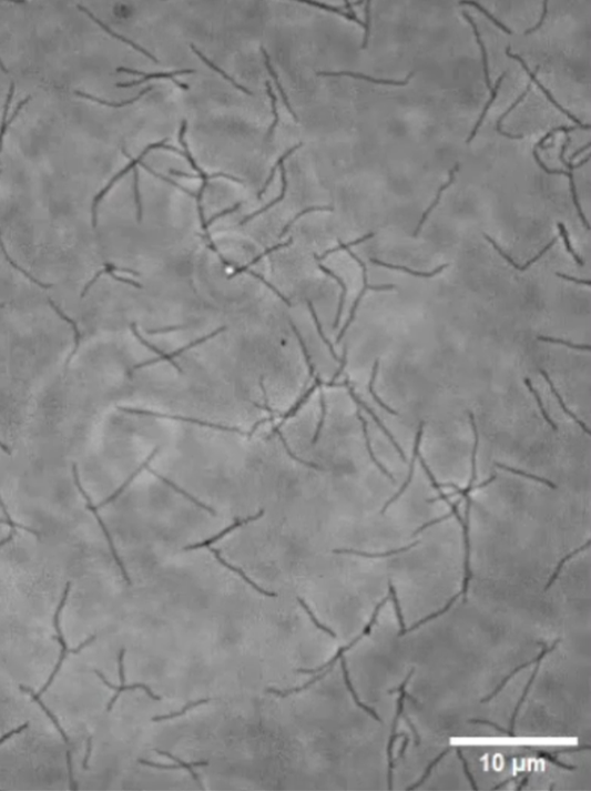 図1 位相差顕微鏡像により捉えたスピロプラズマ
